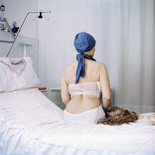 A woman sits on a hospital bed next to her wig, after surgery to remove a cancerous tumour