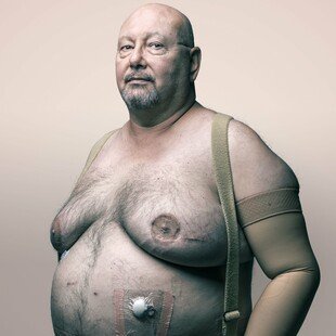 Portrait of a man who is in remission from breast cancer