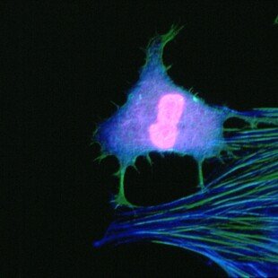 Mouse fibroblast cell about to divide