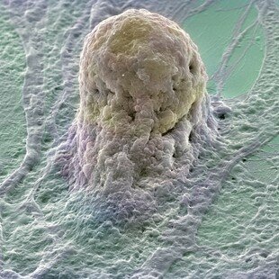 Human embryonic stem cell (gold) growing on a layer of supporting cells (fibroblasts)