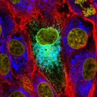 Mumps virus protein in cultured cells