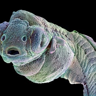 One of the winning images for the 2014 Wellcome Image Awards. Scanning electron micrograph of a four-day-old zebrafish embryo by Annie Cavanagh and David McCarthy.
