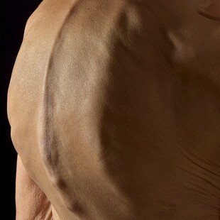 One of the winning images for the 2015 Wellcome Image Awards. Photograph of a 79-year-old woman’s back, showing an abnormally curved spine by Mark Bartley, Cambridge University Hospitals NHS Foundation Trust.