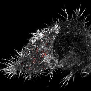 One of the winning images for the 2015 Wellcome Image Awards. Super-resolution micrograph of a natural killer (NK) cell by N Dieckmann and N Lawrence, University of Cambridge.